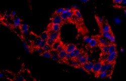 SNX1 Antibody, Novus Biologicals 0.1mL; Unlabeled:Antibodies, Polyclonal
